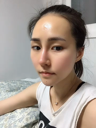 【韓国整形/韓国美容整形】輪郭3点後のビフォーアフター動画の記事動画