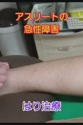 トリガーポイント治療とは…の記事動画