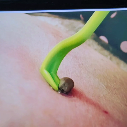 マダニに注意！の記事動画