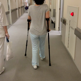 両側人工股関節置換術 術後2週間の画像