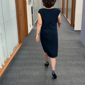 両側人工股関節置換術　術後26週間目の画像