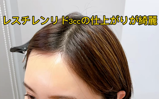 レスチレンリドのおでこヒアルロン酸が良かった。の記事動画