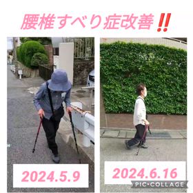 ☆腰椎すべり症の改善事例☆の画像