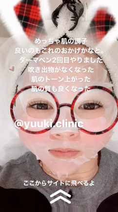 ベルベットスキンの記事動画