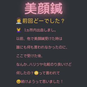美顔鍼の感想♪の画像