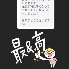 美顔鍼感想♪の画像
