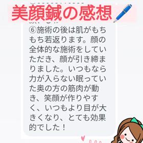 美顔鍼の感想♪の画像