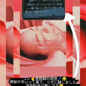 美顔鍼の感想の画像
