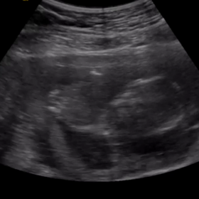 【14w4d】妊婦健診※エコー動画あり※の画像