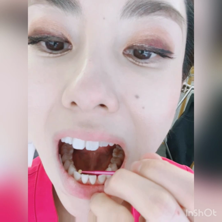 歯医者でも歯が欠けることがある話の記事動画