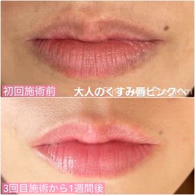 大人のくすみ唇をピンクへの画像