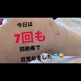膝の画像
