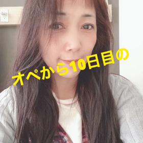 膝の画像