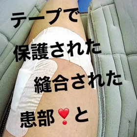 膝の画像