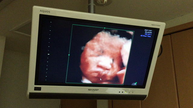 産み分け法の結果を発表します！の記事動画