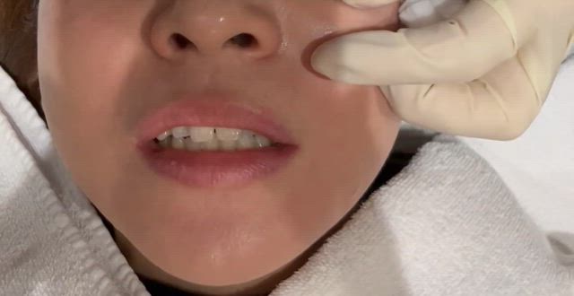 激変の記事動画
