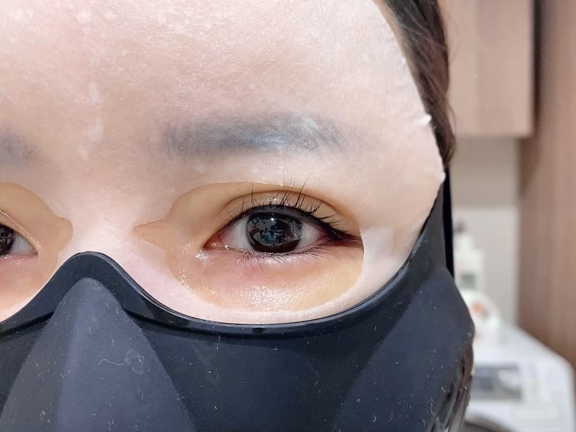 メディリフトを7日間使ったビフォーアフターの記事動画