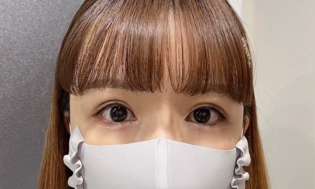 【裏留め二重埋没法】2日目の記事動画