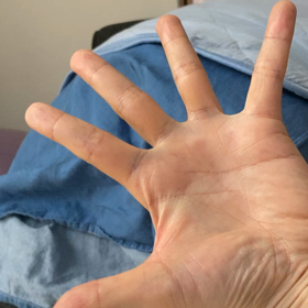 不随意運動（動画）治せる方法ありませんかの画像