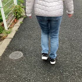 脛骨プレート抜釘　術後113日目　意外と普通？の画像