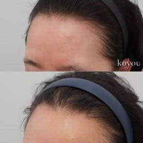 骨腫除去手術 症例+手術映像の画像