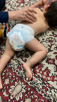 小児脳腫瘍の術後ケアとしての小児はり11【脈絡叢乳頭腫】【水頭症】【施術経過④】まとめの記事動画