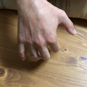 今現在の右手の画像