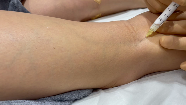 静脈瘤治療！の記事動画