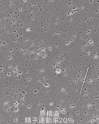 精液検査の動画です！の記事動画