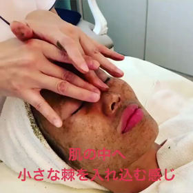 Christinaピーリングの画像