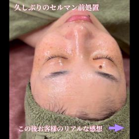 【セルマン前処置】リアルなレビューの画像