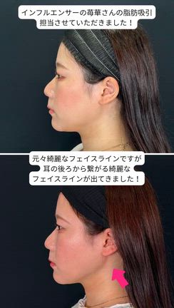 【苺華さん@ichika_a】なぜ彼女は県を越え僕を指名したのかの記事動画