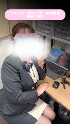 最後のピースを埋める信頼。自院スタッフが選んだウエスト脂肪吸引と痛みのない理由の記事動画