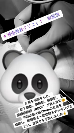 ★絶対美感★前田Drによるお目元の記事動画