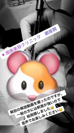 ★絶対美感★前田Drによるお目元の記事動画