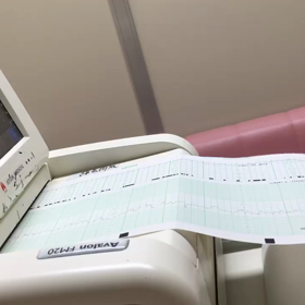 心音モニターの画像