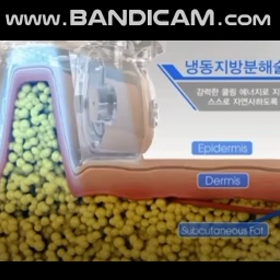 気になる脂肪はミオル韓医院のクールシェイピングで撃退！の画像