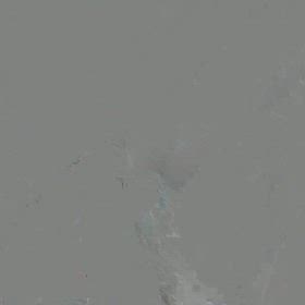 脳出血8日目　マヒの手を動かすの画像