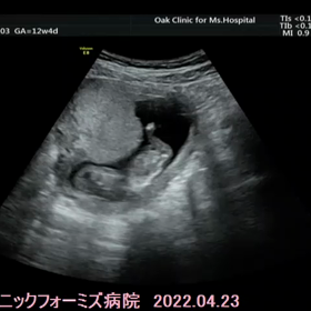 【12w4d】妊婦健診の画像