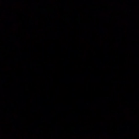 もともと金属アレルギーなの。の画像