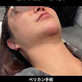 2026/03/17の画像