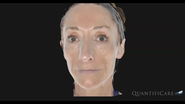 3Dカメラを導入しています♪の記事動画