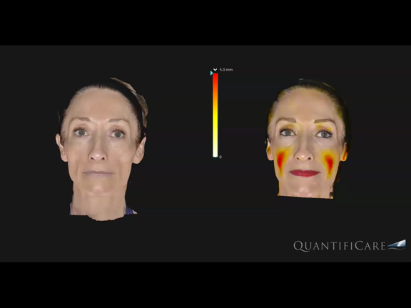 3Dカメラを導入しています♪の記事動画
