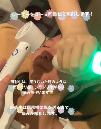 最新治療！moxi 受けてみましたの記事動画
