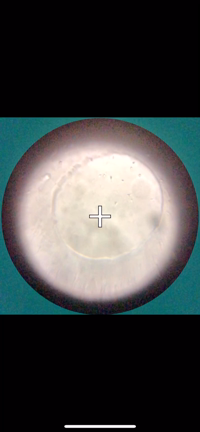☆MEN'S LOUPE で精子観察の記事動画