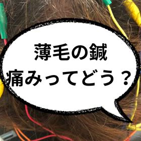 薄毛の鍼　痛みってどう？　#のむち鍼の画像