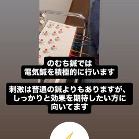 変化を期待できる電気鍼の画像
