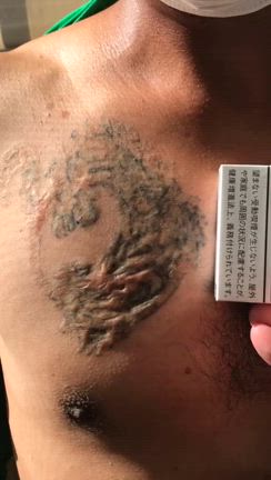 リカバリータトゥー　プレイハンドの記事動画
