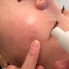 気軽にはじめられるシミ改善☆の画像