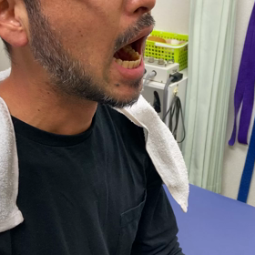 顎関節症で半年以上2センチ位しか口が開かない患者さんの画像